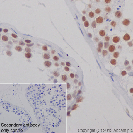 Immunohistochemistry (Formalin/PFA-fixed paraffin-embedded sections) - Anti-KAT7 / Hbo1 / MYST2 antibody [EPR18473] - BSA and Azide free (AB240315), expandable thumbnail