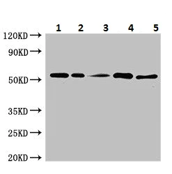 Western blot - Anti-KAT8 / MYST1 / MOF antibody (AB224597)