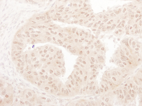Immunohistochemistry (Formalin/PFA-fixed paraffin-embedded sections) - Anti-KAT8 / MYST1 / MOF antibody (AB72056), expandable thumbnail
