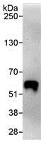 Immunoprecipitation - Anti-KAT8 / MYST1 / MOF antibody (AB72056), expandable thumbnail