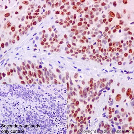 Immunohistochemistry (Formalin/PFA-fixed paraffin-embedded sections) - Anti-KAT8 / MYST1 / MOF antibody [EPR15803] (AB200660)