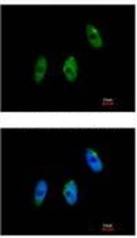 Immunocytochemistry/ Immunofluorescence - Anti-KAT9 / Elp3 antibody (AB113228)