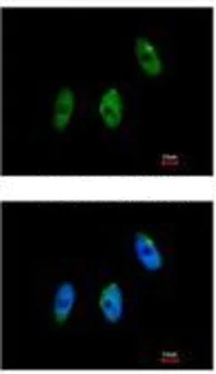 Immunocytochemistry/ Immunofluorescence - Anti-KAT9 / Elp3 antibody (AB113228)