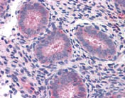 Immunohistochemistry (Formalin/PFA-fixed paraffin-embedded sections) - Anti-KAT9 / Elp3 antibody (AB113228)