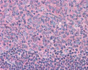Immunohistochemistry (Formalin/PFA-fixed paraffin-embedded sections) - Anti-KAT9 / Elp3 antibody (AB113228)