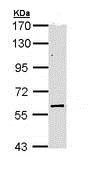 Western blot - Anti-KAT9 / Elp3 antibody (AB113228)
