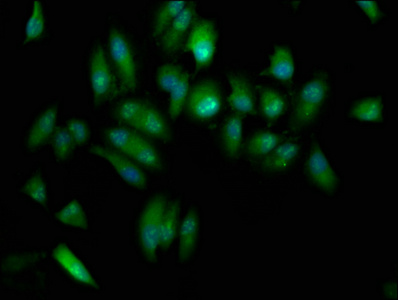 Immunocytochemistry/ Immunofluorescence - Anti-KAT9 / Elp3 antibody (AB236800)