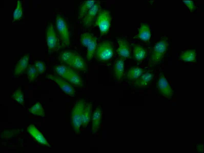 Immunocytochemistry/ Immunofluorescence - Anti-KAT9 / Elp3 antibody (AB236800)