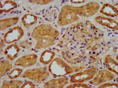 Immunohistochemistry (Formalin/PFA-fixed paraffin-embedded sections) - Anti-KAT9 / Elp3 antibody (AB236800)