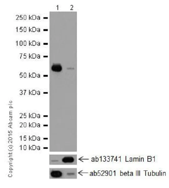 Western blot - Anti-KAT9 / Elp3 antibody [EPR18472] (AB190907)