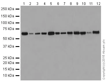 Western blot - Anti-KAT9 / Elp3 antibody [EPR18472] (AB190907)