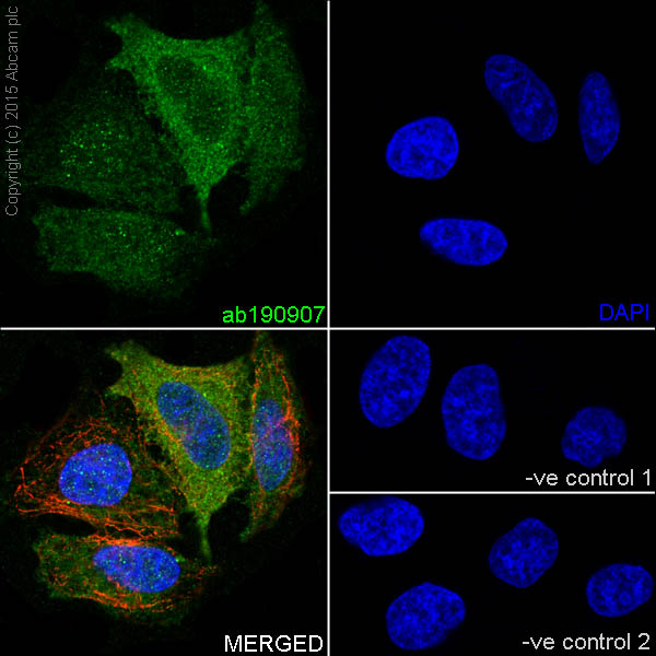 Immunocytochemistry/ Immunofluorescence - Anti-KAT9 / Elp3 antibody [EPR18472] - BSA and Azide free (ab251047), expandable thumbnail