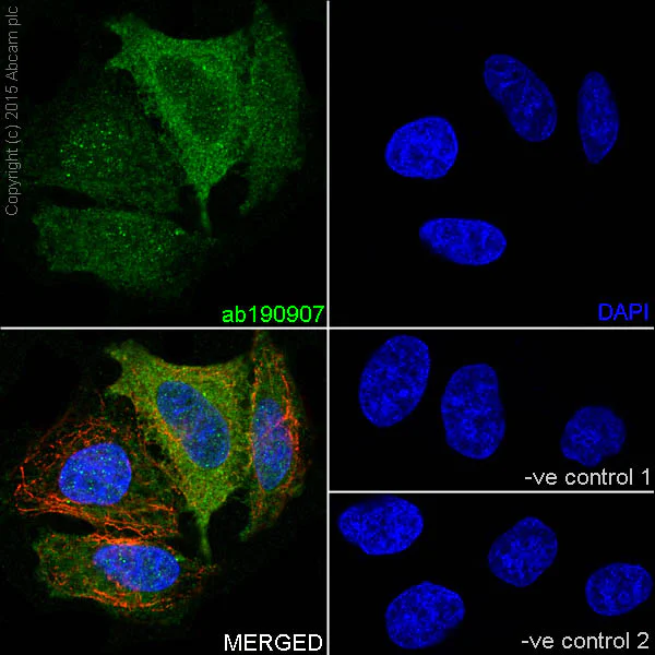 Immunocytochemistry/ Immunofluorescence - Anti-KAT9 / Elp3 antibody [EPR18472] - BSA and Azide free (AB251047)