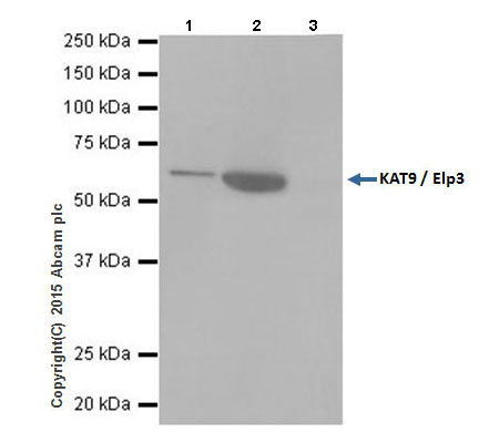 Immunoprecipitation - Anti-KAT9 / Elp3 antibody [EPR18472] - BSA and Azide free (AB251047), expandable thumbnail