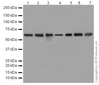 Western blot - Anti-KAT9 / Elp3 antibody [EPR18472] - BSA and Azide free (AB251047)