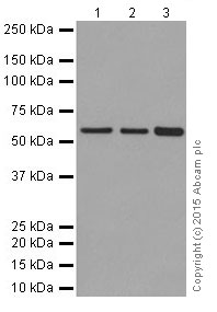 Western blot - Anti-KAT9 / Elp3 antibody [EPR18472] - BSA and Azide free (AB251047), expandable thumbnail