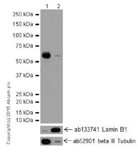 Western blot - Anti-KAT9 / Elp3 antibody [EPR18472] - BSA and Azide free (AB251047), expandable thumbnail