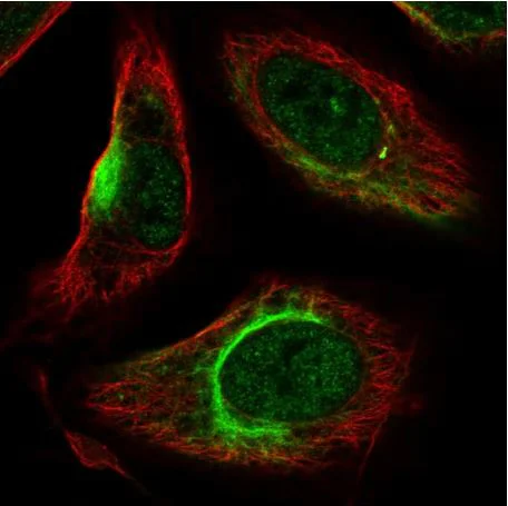 Immunocytochemistry/ Immunofluorescence - Anti-KATNAL2 antibody (AB184829)