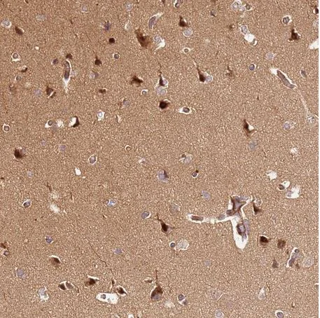 Immunohistochemistry (Formalin/PFA-fixed paraffin-embedded sections) - Anti-KATNAL2 antibody (AB184829)