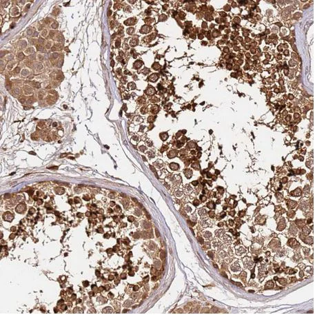 Immunohistochemistry (Formalin/PFA-fixed paraffin-embedded sections) - Anti-KATNAL2 antibody (AB184829)