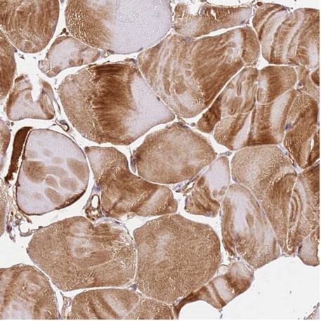 Immunohistochemistry (Formalin/PFA-fixed paraffin-embedded sections) - Anti-KATNAL2 antibody (AB184829)