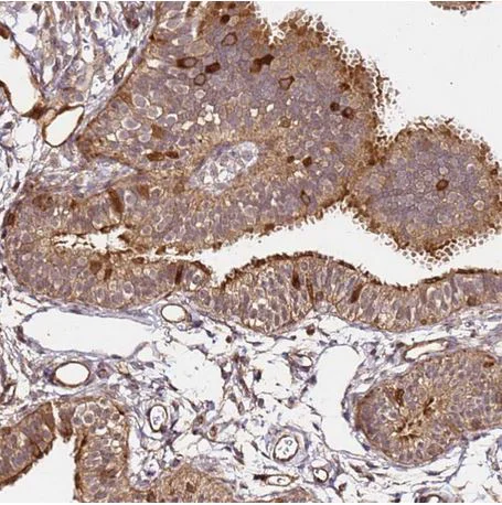 Immunohistochemistry (Formalin/PFA-fixed paraffin-embedded sections) - Anti-KATNAL2 antibody (AB184829)