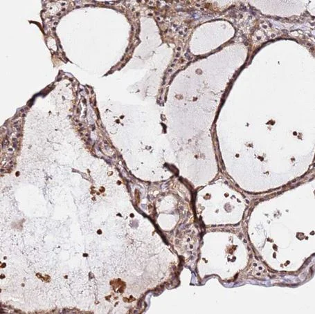 Immunohistochemistry (Formalin/PFA-fixed paraffin-embedded sections) - Anti-KATNAL2 antibody (AB184829)
