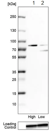 Western blot - Anti-KATNAL2 antibody (AB184829)