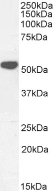 Western blot - Anti-KATNAL2 antibody (AB239220)