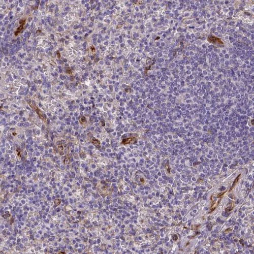 Immunohistochemistry (Formalin/PFA-fixed paraffin-embedded sections) - Anti-Kazrin antibody (AB244447)