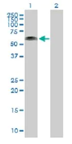 Western blot - Anti-Kazrin antibody (AB88752)