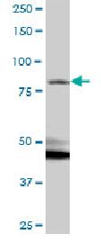 Western blot - Anti-Kazrin antibody (AB88752)