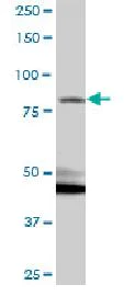 Western blot - Anti-Kazrin antibody (AB88752)
