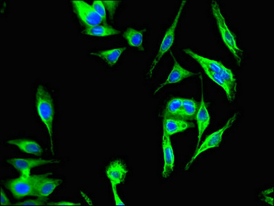 Immunocytochemistry/ Immunofluorescence - Anti-KBTB6/KBTBD6 antibody (AB222971)