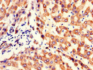 Immunohistochemistry (Formalin/PFA-fixed paraffin-embedded sections) - Anti-KBTB6/KBTBD6 antibody (AB222971)
