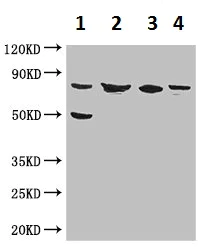 Western blot - Anti-KBTB6/KBTBD6 antibody (AB222971)