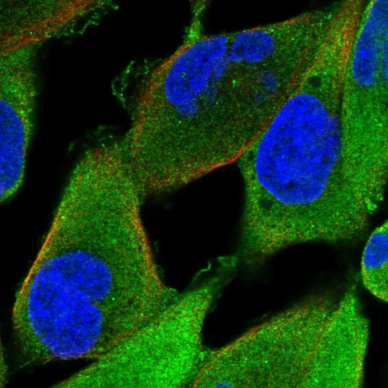 Immunocytochemistry/ Immunofluorescence - Anti-KBTBD10/KRP1 antibody (AB252972)