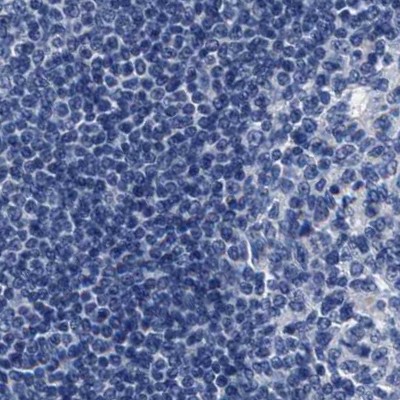 Immunohistochemistry (Formalin/PFA-fixed paraffin-embedded sections) - Anti-KBTBD10/KRP1 antibody (AB252972)