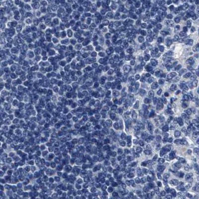 Immunohistochemistry (Formalin/PFA-fixed paraffin-embedded sections) - Anti-KBTBD10/KRP1 antibody (AB252972)