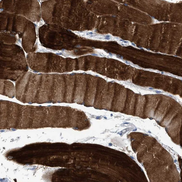 Immunohistochemistry (Formalin/PFA-fixed paraffin-embedded sections) - Anti-KBTBD10/KRP1 antibody (AB252972)