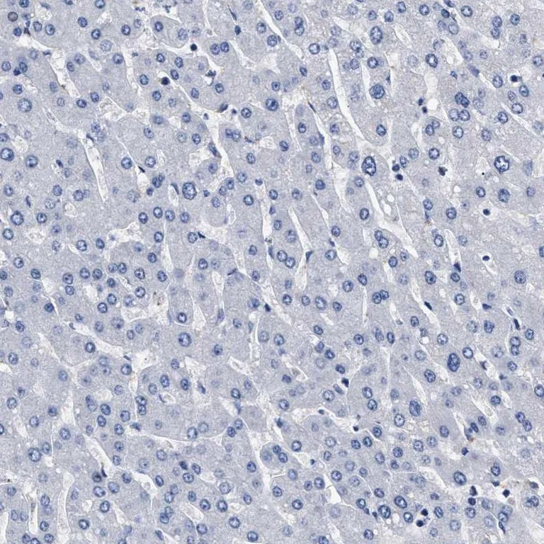 Immunohistochemistry (Formalin/PFA-fixed paraffin-embedded sections) - Anti-KBTBD10/KRP1 antibody (AB252972)