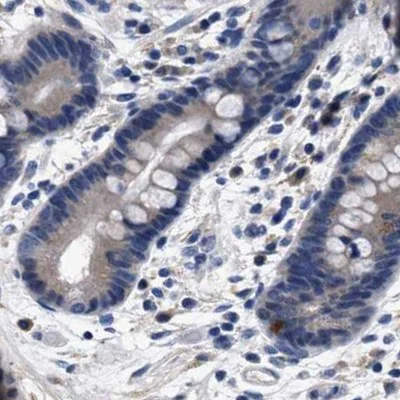 Immunohistochemistry (Formalin/PFA-fixed paraffin-embedded sections) - Anti-KBTBD10/KRP1 antibody (AB252972)
