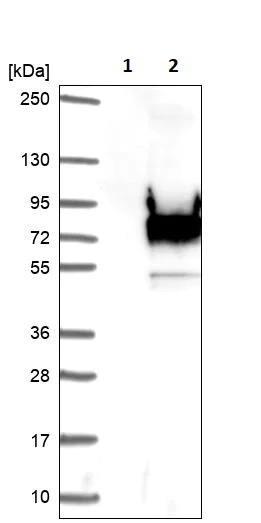 Western blot - Anti-KBTBD10/KRP1 antibody (AB252972)