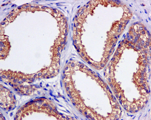 Immunohistochemistry (Formalin/PFA-fixed paraffin-embedded sections) - Anti-KBTBD11 antibody [EPR10056(2)(B)] (AB169551), expandable thumbnail