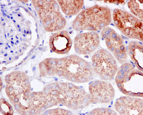 Immunohistochemistry (Formalin/PFA-fixed paraffin-embedded sections) - Anti-KBTBD11 antibody [EPR10056(2)(B)] - BSA and Azide free (AB249501)