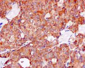 Immunohistochemistry (Formalin/PFA-fixed paraffin-embedded sections) - Anti-KBTBD11 antibody [EPR10056(2)(B)] - BSA and Azide free (AB249501)