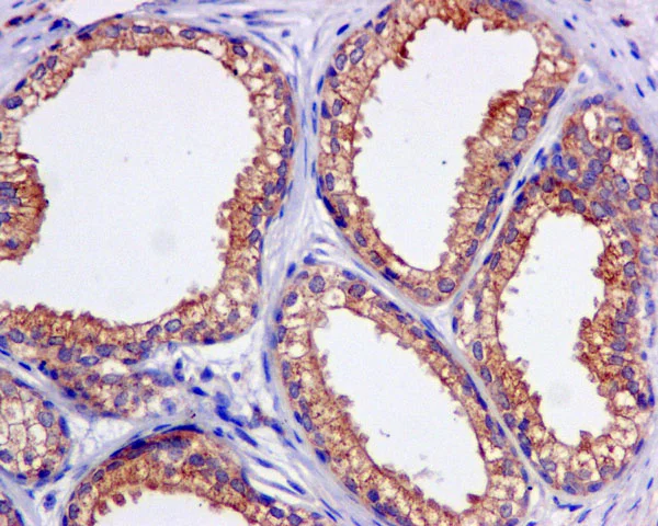 Immunohistochemistry (Formalin/PFA-fixed paraffin-embedded sections) - Anti-KBTBD11 antibody [EPR10056(2)(B)] - BSA and Azide free (AB249501)
