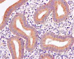 Immunohistochemistry (Formalin/PFA-fixed paraffin-embedded sections) - Anti-KBTBD11 antibody [EPR10056(2)(B)] - BSA and Azide free (AB249501)