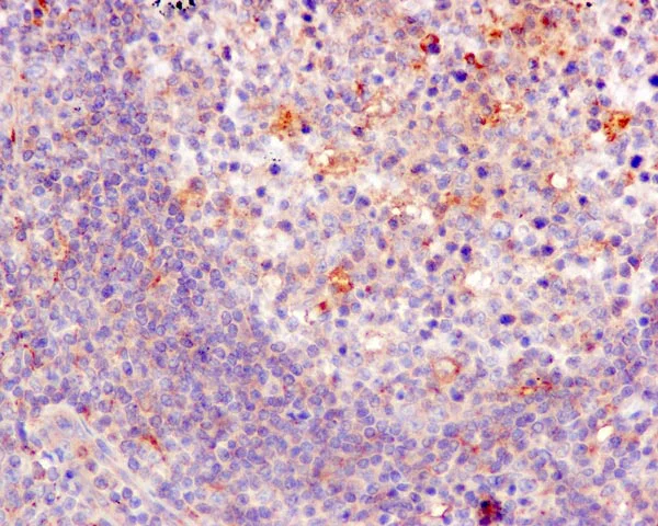 Immunohistochemistry (Formalin/PFA-fixed paraffin-embedded sections) - Anti-KBTBD11 antibody [EPR10056(2)(B)] - BSA and Azide free (AB249501)