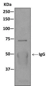 Immunoprecipitation - Anti-KBTBD11 antibody [EPR10056(2)(B)] - BSA and Azide free (AB249501)